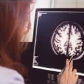 z1-170x170 Mild Concussion Treatment