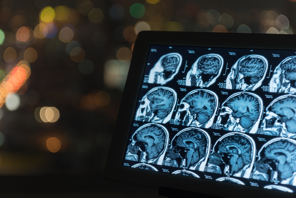 Neurology Diagnostics
