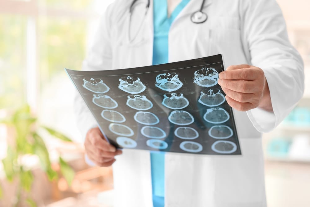 Seeing a Neurologist in Manhattan after an Accident
